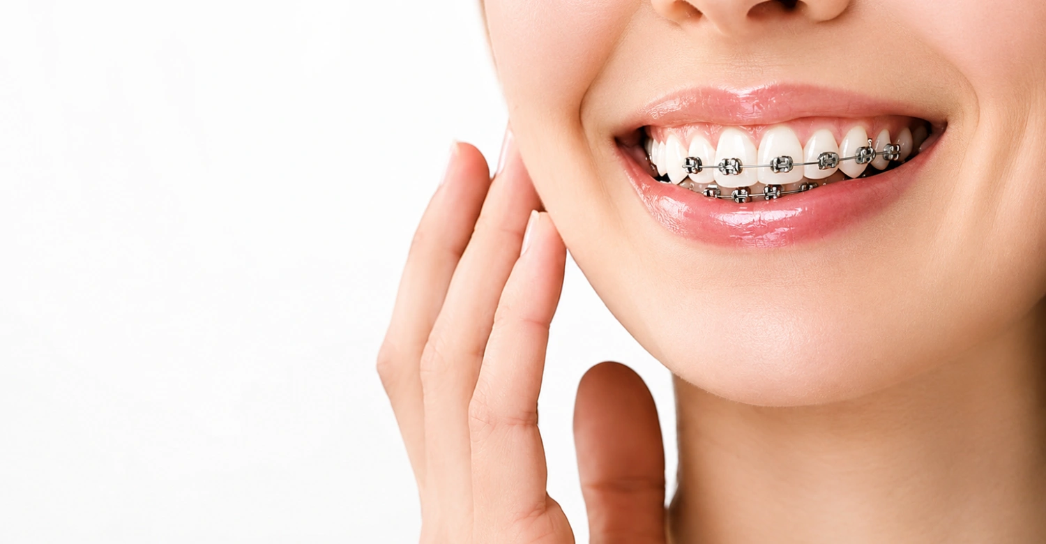 do orthodontic assistants put braces on1
